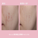 維C美肌益生菌療程(升級配方) (有效日期:2026年7月31日)