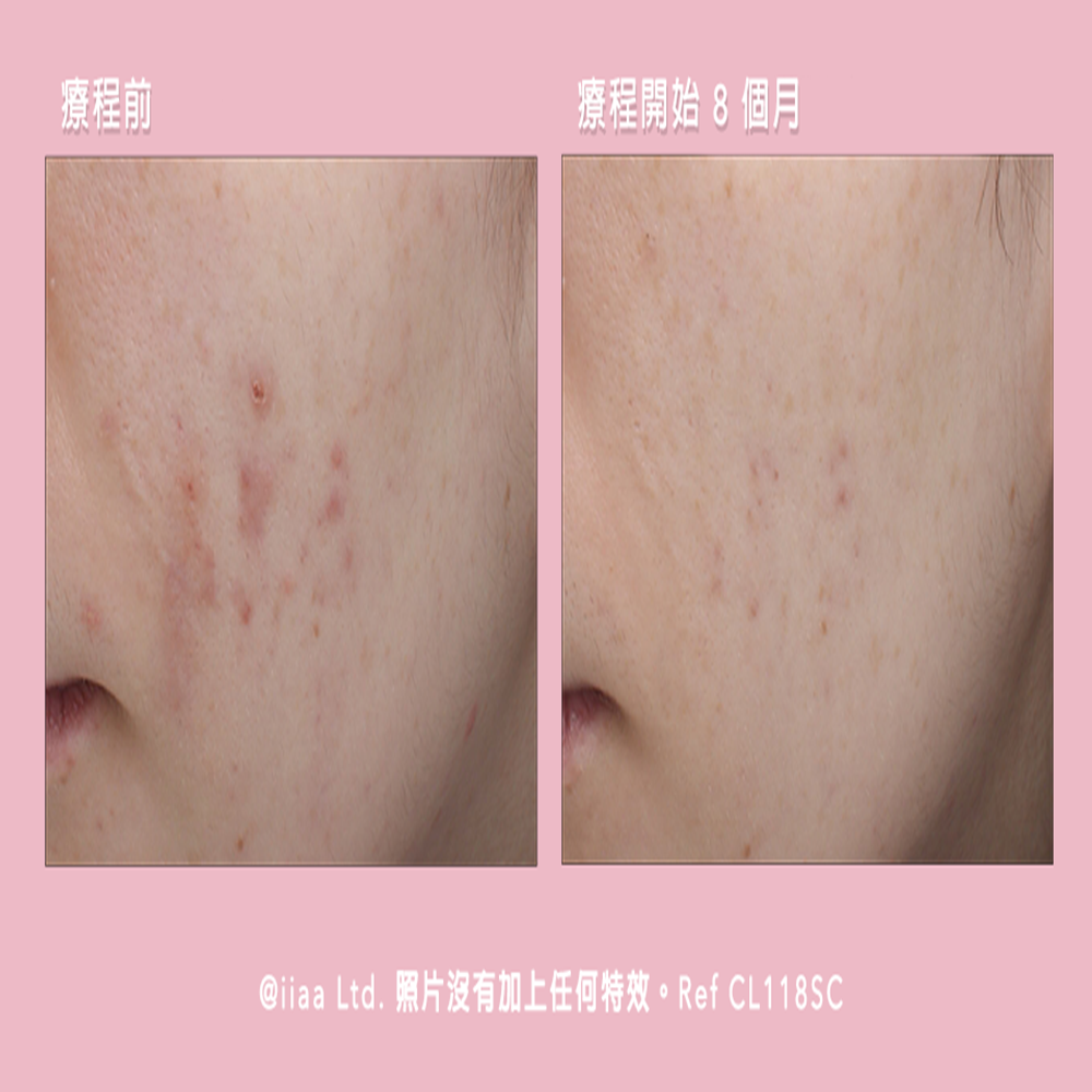 維C美肌益生菌 ( 旅行裝 )