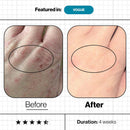 激活膠原回彈療程