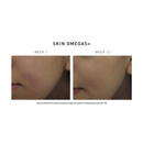 【美肌抗皺】套裝