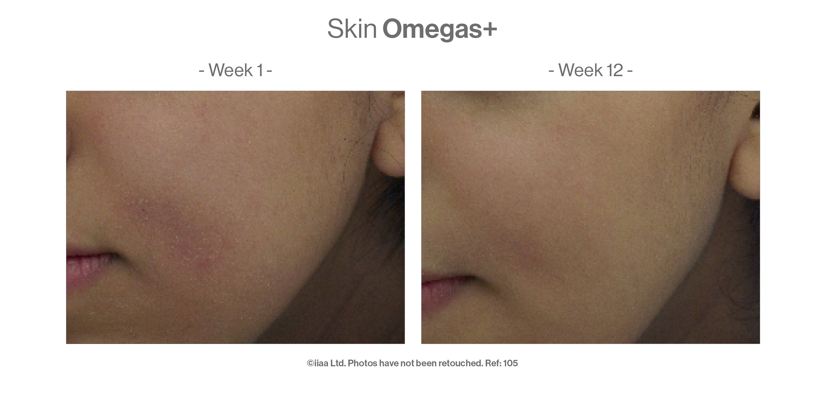 Skin Omegas™ (10 caps)